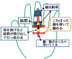 �΂ˎw�@���x���N�@�E�}�T�S�����@